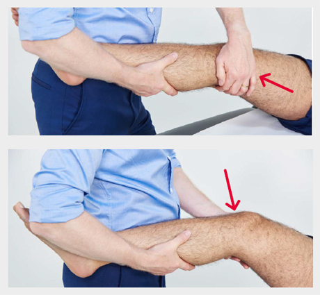 医学专业评估通过收缩膝盖内侧和外侧副韧带稳定15°,时而强调联合线两侧将一只手放在对面的合模线,测试和应用力较低的胫骨。