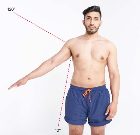 一个男人的手臂的图像，以评估痛苦的弧线。