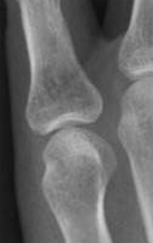 X-ray of a synovial joint and it’s periarticular structures