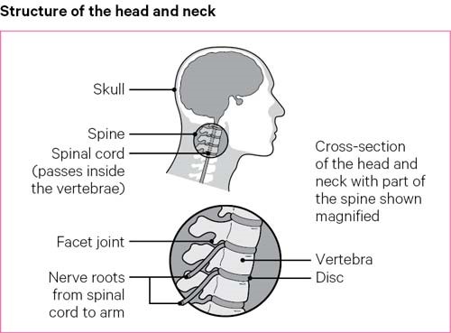 头部和颈部的结构包括颅骨，脊髓，刻面关节和神经根。